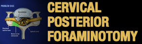 Cervical-PosterioR