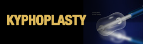 Kyphoplasty