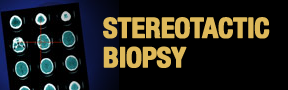 Stereotactic-Biopsy