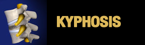 Kyphosis